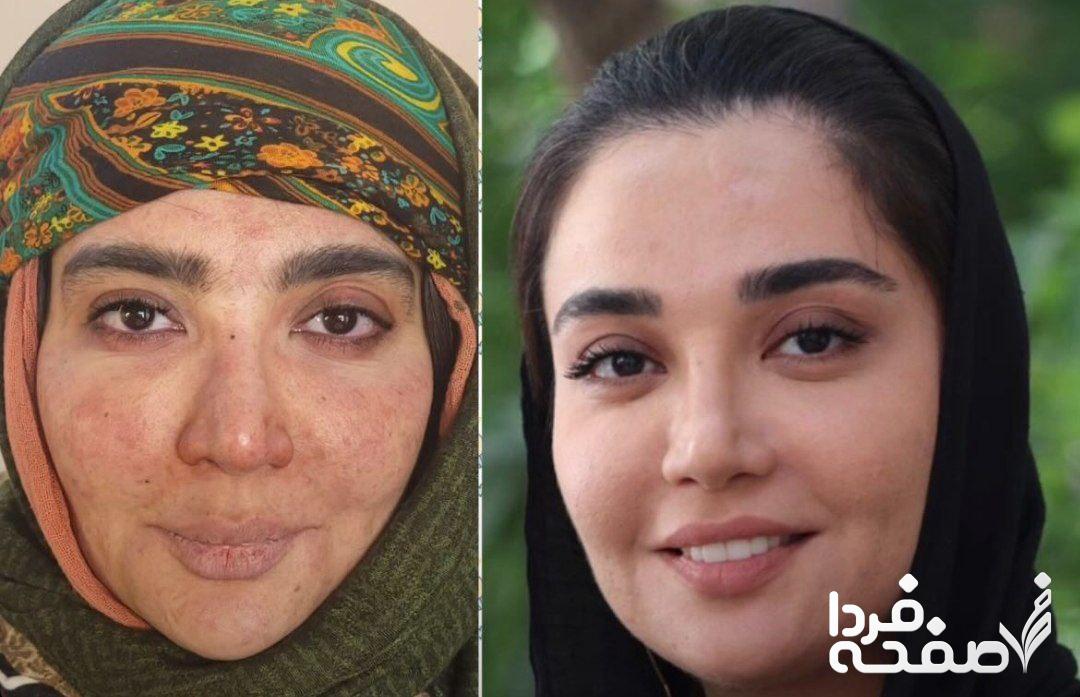 بازیگر نقش عطا در نون خ کیست؟ + عکس های بیرون سریال