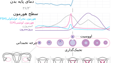 تنبلی تخمدان