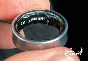 حلقه سامسونگ خطرناک شد / باتری ورم کرد و کار به بیمارستان کشیده شد