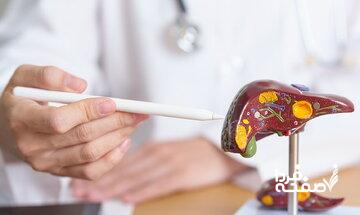 ۶ مکمل و ویتامین برای کنترل بیماری کبد چرب و آنزیمهای کبدی