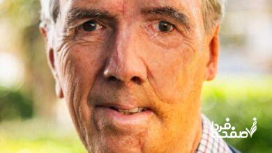 چاپ سهبعدی صورت