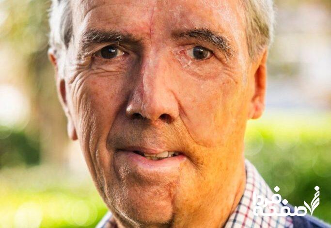 چاپ سه‌بعدی صورت