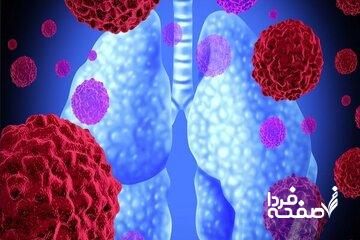 علت ۸۵ درصد سرطان‌های ریه