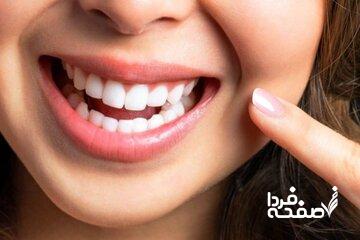 خوراکیهای مفید برای سلامت دندان