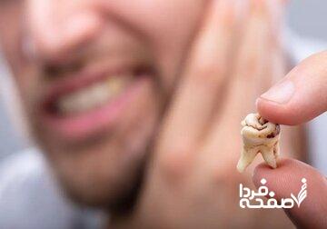 کسیکه بهدلیل مشکلات اقتصادی گوشت و شیر نمیخورد قطعا سلامت دندان در اولویتش نیست/ کاهش کیفیت آموزش پزشکی؛ با رتبه چهل هزار و سهمیه دکتر میشوند!